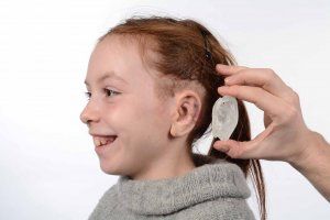 Ellies 3D-gedrucktes Ohr